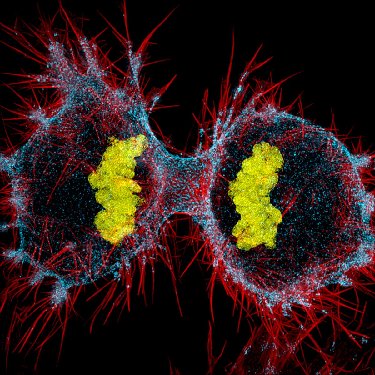 človeška hela-celica v postopku delitve celic