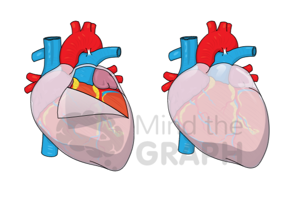 heart pericardium