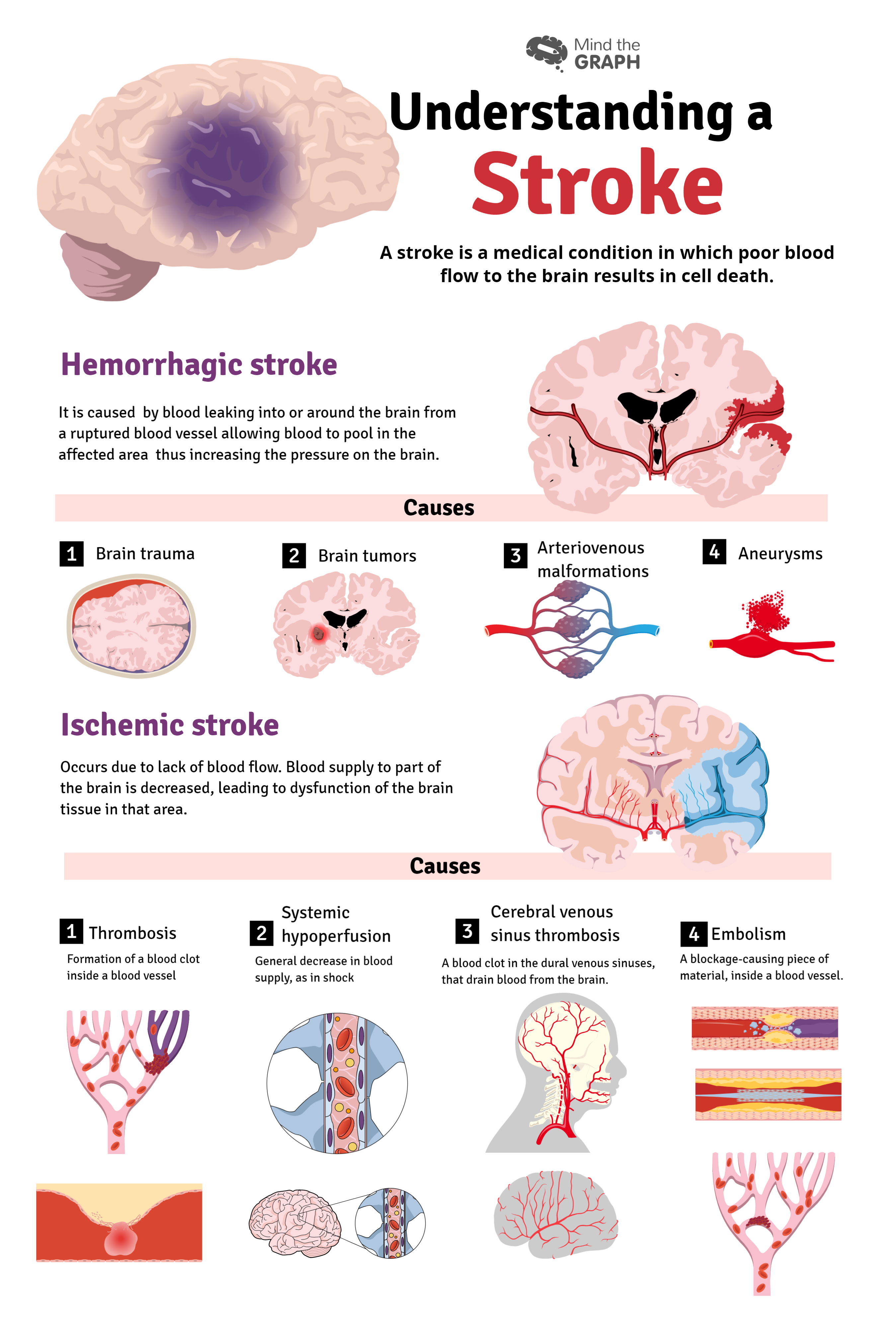 stroke causes cardiology3
