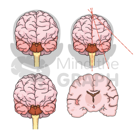 Illustrations scientifiques du cerveau du bébé